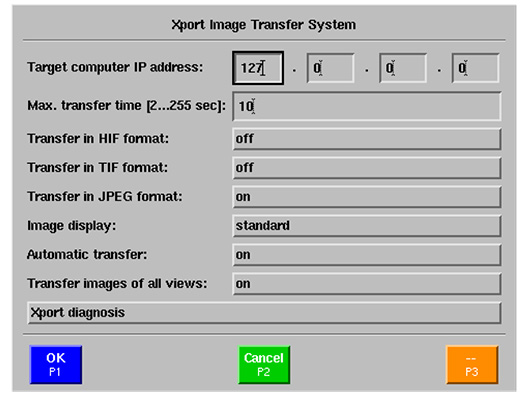 XPORT™